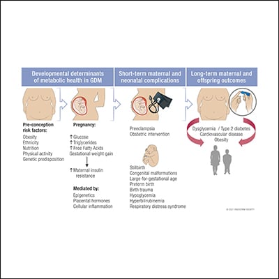 A Clinical Update on Gestational Diabetes Mellitus | Endocrine Society