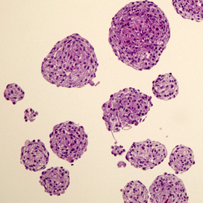 Cell Therapy for Adrenal Insufficiency Fig 2C
