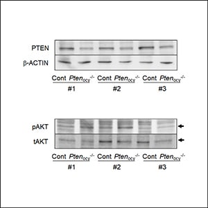 Lack of PTEN in Osteocytes Increases Lipocalin-2 Level and Confers ...