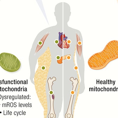 Mitochondria and Non-Communicable Chronic Diseases | Endocrine Society