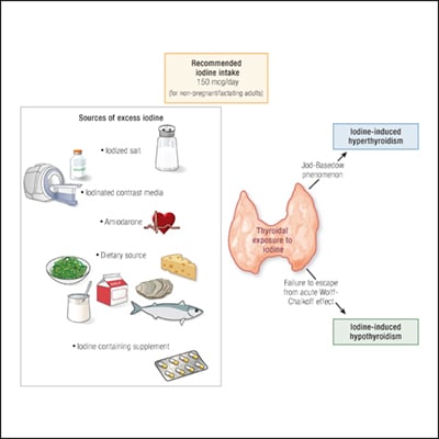 Risks of Iodine Excess Endocrine Society