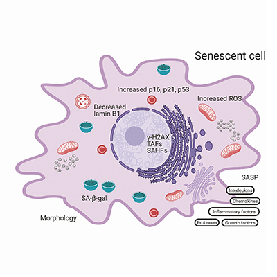 Role of Cellular Senescence in Type II Diabetes | Endocrine Society
