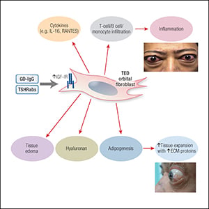 Teprotumumab for the Treatment of Thyroid Eye Disease | Endocrine Society