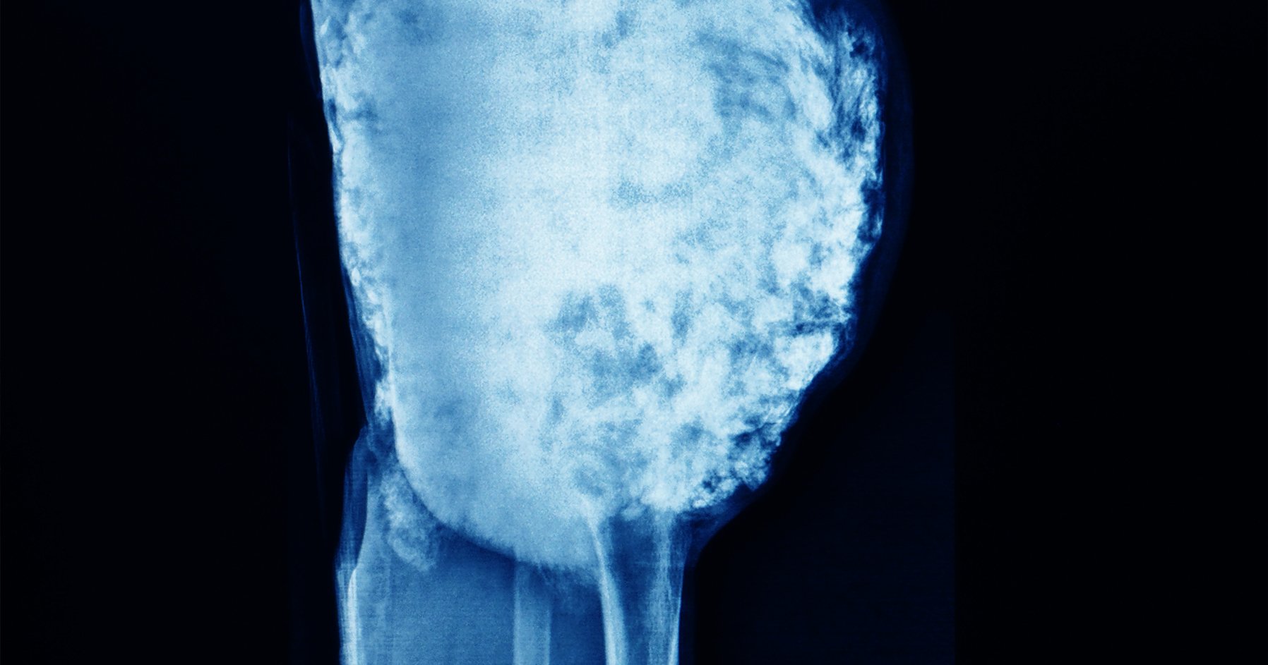 Image of bone tissue in the body.