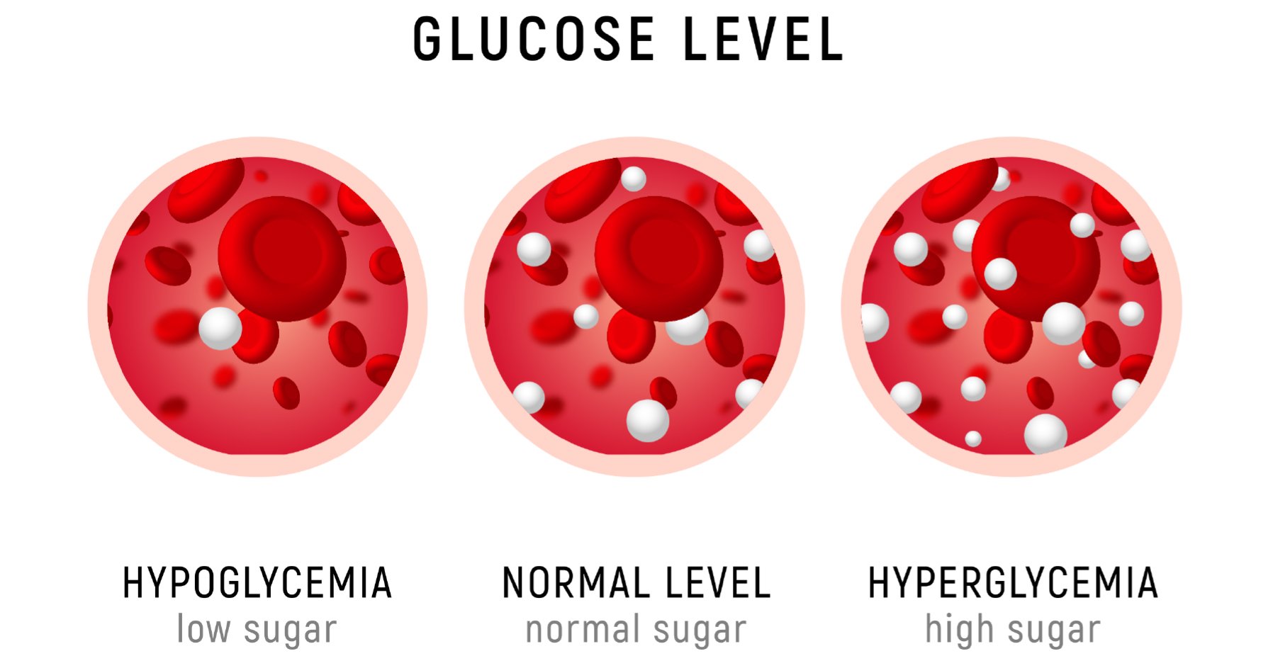 Symptoms of High Blood Sugar (Hyperglycemia)