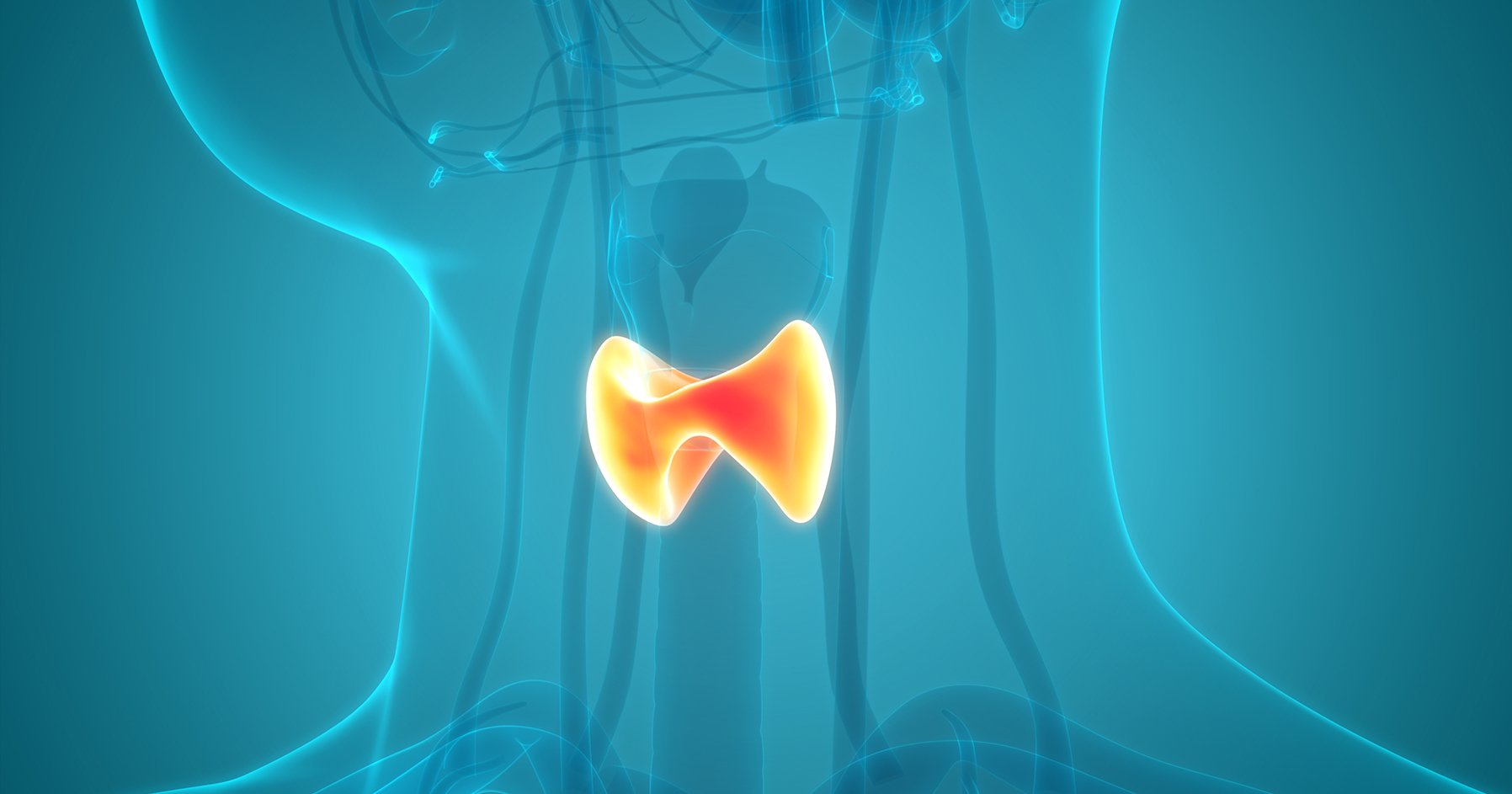 Thyroid Hypoplasia as a Cause of Congenital Hypothyroidism in