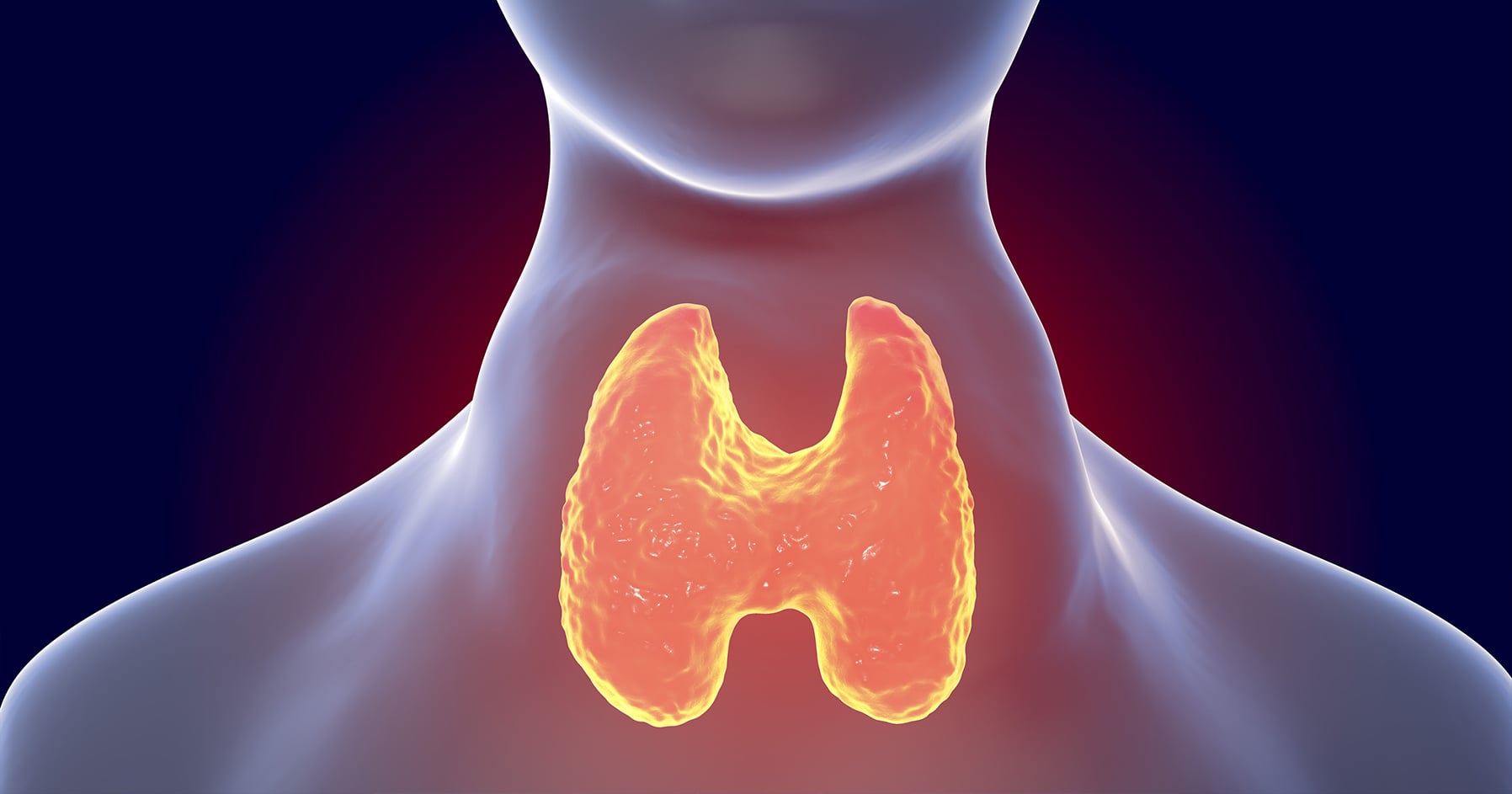 Graves' Disease Endocrine Society