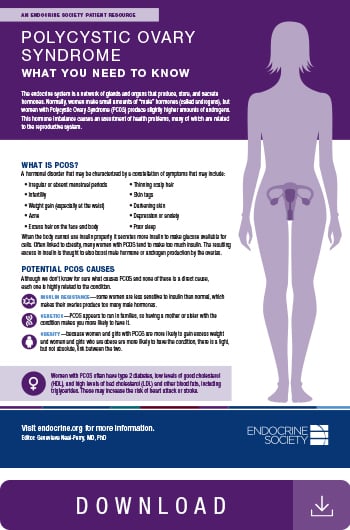 Image of polycystic ovary syndrome infographic.